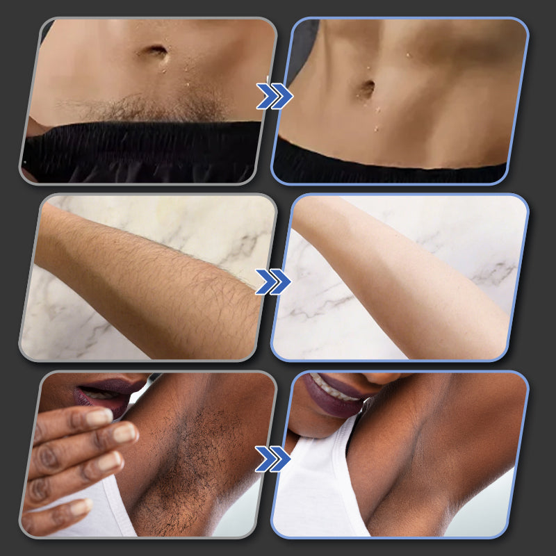 🎁Early Christmas sale - 49% off🎅-New Upgraded Pocket Razor-8