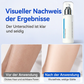 🥳HEISSER VERKAUF 2026💞ÜBER 50.000 VERKAUFT!🧊✨ Eiskühlende Haarentfernung – Schmerzfreie Haarentfernung bis zur Wurzel | Premium Qualität