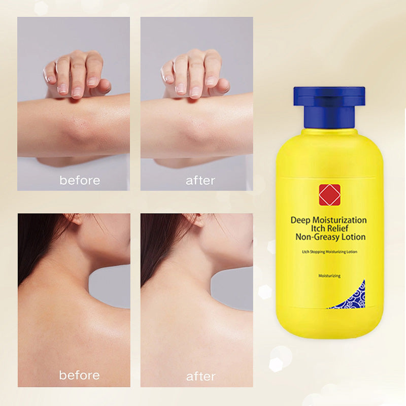 🎁Buy 1 Get 1 Free🔥Deep Moisturization Itch Relief Non-Greasy Lotion-4