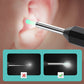 🔥🖤Black Friday Sale:50% OFF🔥Endoscopic Visual Ear Picker-4