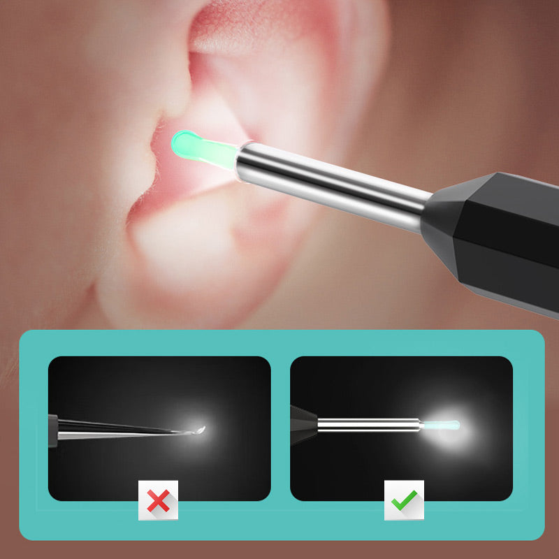 🔥🖤Black Friday Sale:50% OFF🔥Endoscopic Visual Ear Picker-4