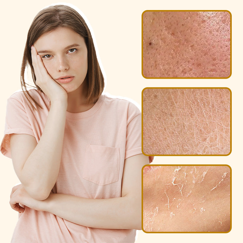 🔥Last Day Promotion 49% OFF🔥Organic Beef Tallow Balm with Honey – Moisturizing Cream-4